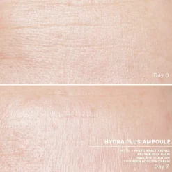 BABOR Ampulconcentraat Hydra Plus