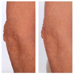 U BEAUTY Beauty The Sculpt Arm-Compound