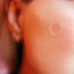 The Coucou Club Coucou Microneedle Pimple Patches